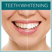 Teeth Whitening